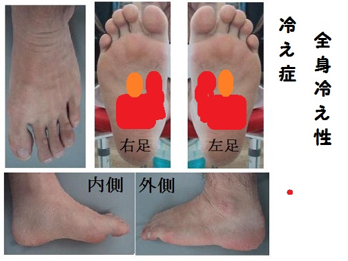 全身冷え性の反射区