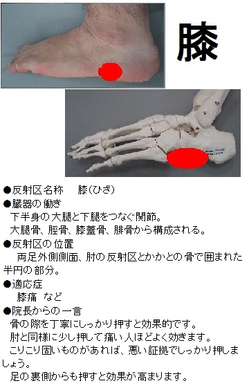 ツボ 足の裏 痛み